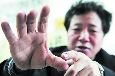 常年累月的铁笔书法，让杨跃进的右手生了一层厚厚的茧。均为石祯专 周和平摄影报道